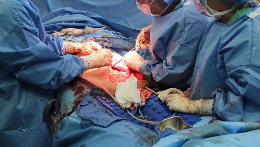 tumour removal