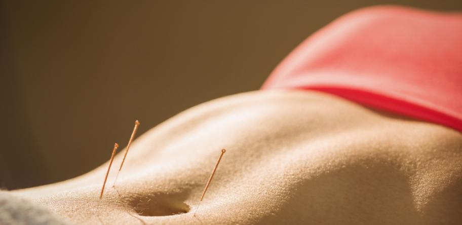 acpuncture woman's torso