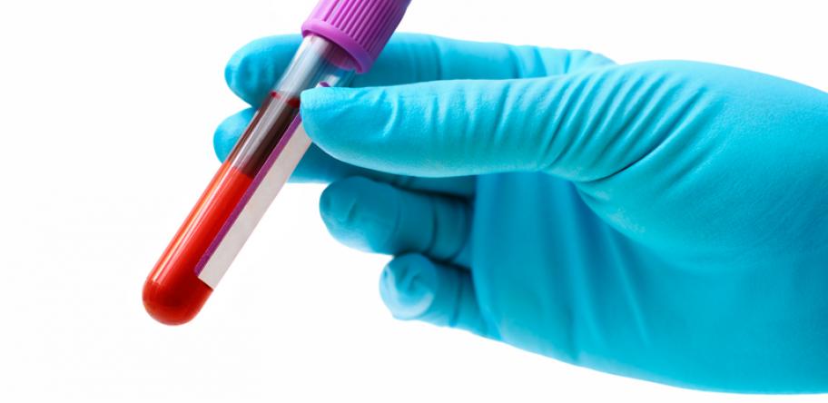 blood test