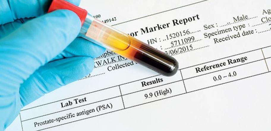 psa2