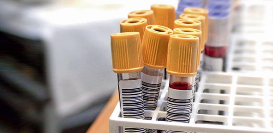 Blood test