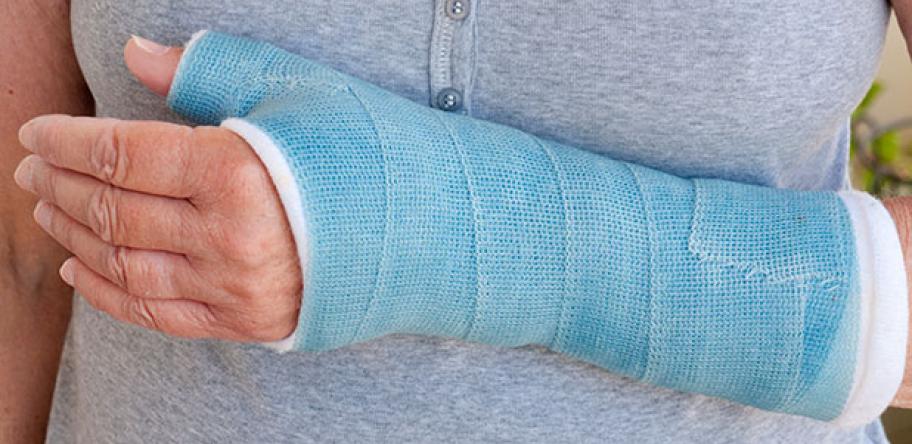 fracture